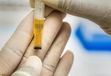 Synthetic Urine Solutions: Addressing Workplace Concerns And Misconceptions
